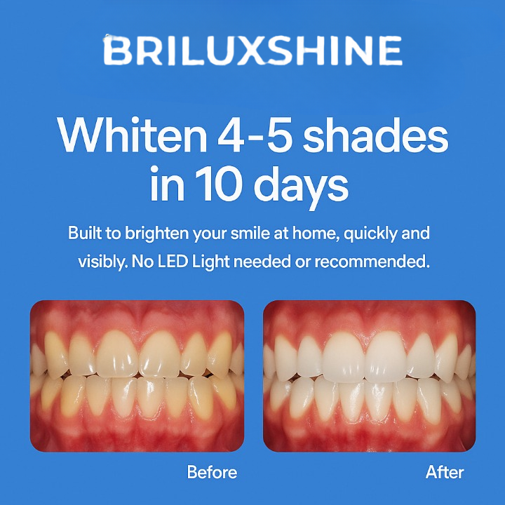 Bandejas para blanqueamiento dental